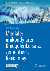 Medialer unikondylärer Kniegelenkersatz: zementiert, fixed Inlay - Christian Lüring