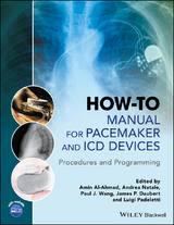 How-to Manual for Pacemaker and ICD Devices - 