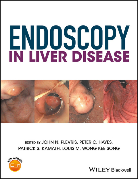 Endoscopy in Liver Disease - 