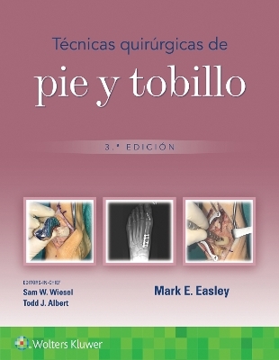 Técnicas quirúrgicas de pie y tobillo - Mark Erik Easley