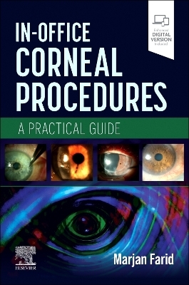 In-Office Corneal Procedures - 