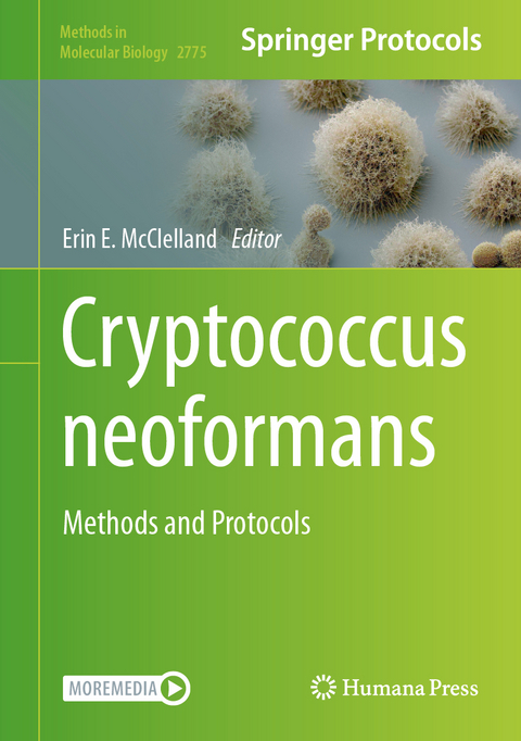 Cryptococcus neoformans - 