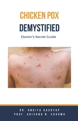 Chickenpox Demystified - Dr Ankita Kashyap, Prof Krishna N Sharma