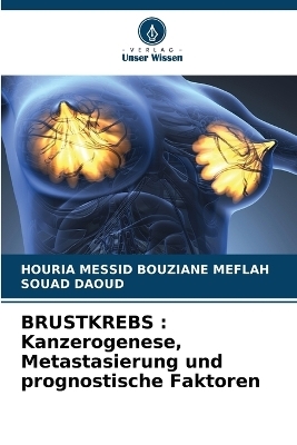 Brustkrebs - HOURIA MESSID BOUZIANE MEFLAH, Souad Daoud