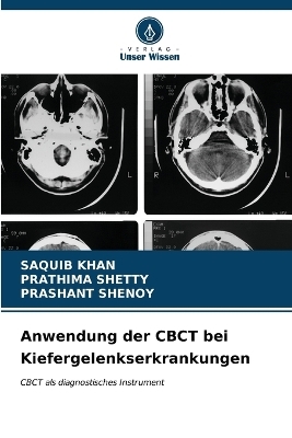 Anwendung der CBCT bei Kiefergelenkserkrankungen - SAQUIB KHAN, Prathima Shetty, Prashant Shenoy