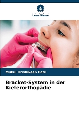 Bracket-System in der Kieferorthopädie - Mukul Hrishikesh Patil