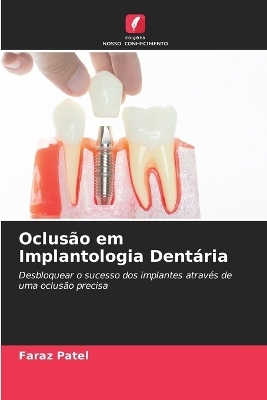 Oclusão em Implantologia Dentária - Faraz Patel