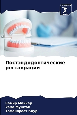 Постэндодонтические реставрации - Самир Маккар, Узма Муштак, Таманпреет Каур