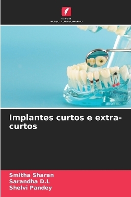 Implantes curtos e extra-curtos - Smitha Sharan, Sarandha D L, Shelvi Pandey