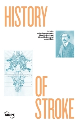 History of Stroke