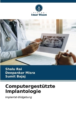 Computergestützte Implantologie - Shalu Rai, Deepankar Misra, Sumit Bajaj