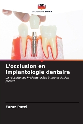 L'occlusion en implantologie dentaire - Faraz Patel