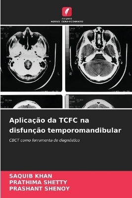 Aplicação da TCFC na disfunção temporomandibular - SAQUIB KHAN, Prathima Shetty, Prashant Shenoy