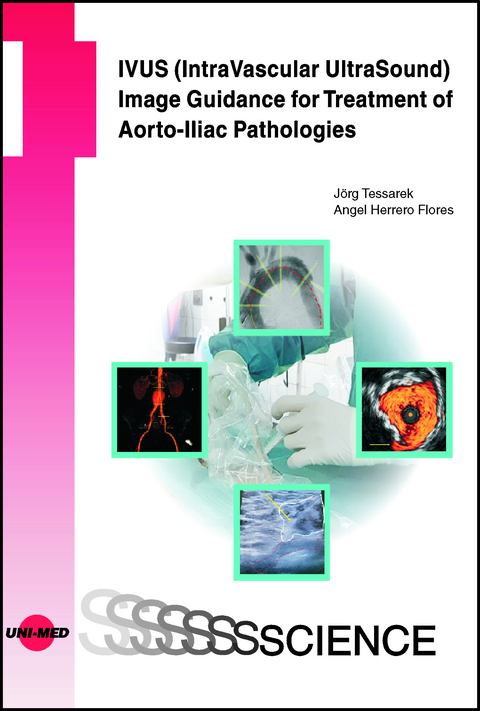 IVUS (IntraVascular UltraSound) Image Guidance for Treatment of Aorto-Iliac Pathologies - Jörg Tessarek, Angel Herrero Flores