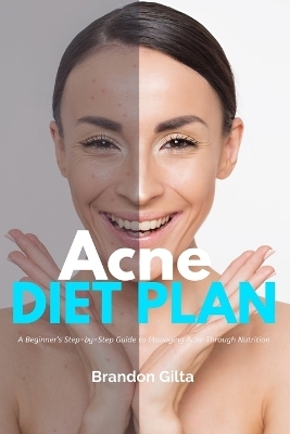 Acne Diet Plan - Brandon Gilta