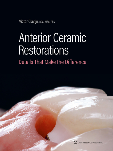 Anterior Ceramic Restorations - Victor Clavijo