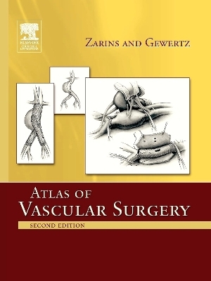 Atlas Of Vascular Surgery - Paperback Edition - Christopher K. Zarins, Bruce L. Gewertz