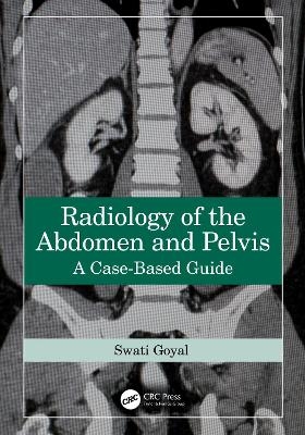 Radiology of the Abdomen and Pelvis - Swati Goyal