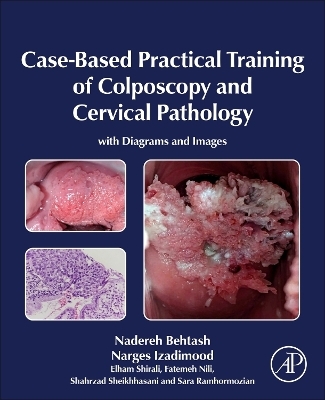 Case-Based Practical Training of Colposcopy and Cervical Pathology - Nadereh Behtash, Narges Izadimood, Elham Shirali, Fatemeh Nili, Shahrzad Sheikhhasani