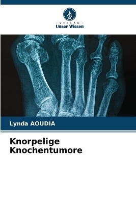 Knorpelige Knochentumore - Lynda Aoudia