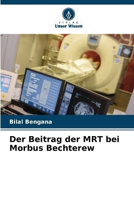 Der Beitrag der MRT bei Morbus Bechterew - Bilal Bengana