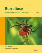 Borreliose -  Ute Fischer,  Bernhard Siegmund