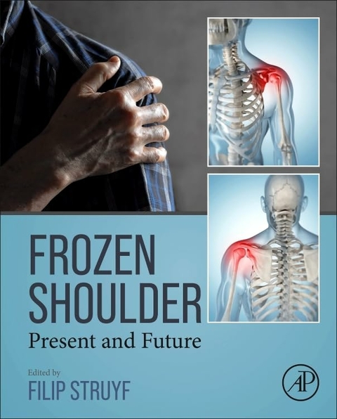 Frozen Shoulder - 