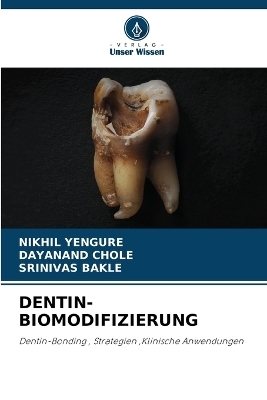 Dentin-Biomodifizierung - Nikhil Yengure, Dayanand Chole, Srinivas Bakle