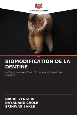 Biomodification de la Dentine - Nikhil Yengure, Dayanand Chole, Srinivas Bakle