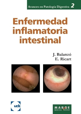 Enfermedad inflamatoria intestinal - Elena Ricart Gómez, Joaquim Balanzó Tintoré