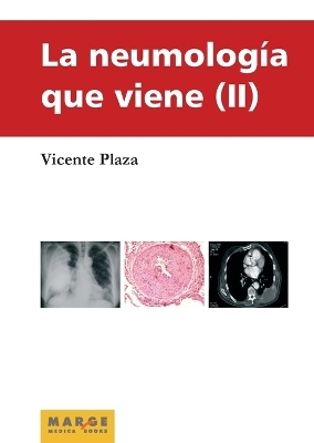 La neumología que viene II - Vicente Plaza