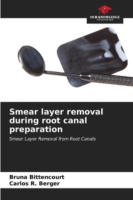 Smear layer removal during root canal preparation - Bruna Bittencourt, Carlos R Berger