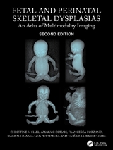 Fetal and Perinatal Skeletal Dysplasias - Hall, Christine M; Offiah, Amaka C; Forzano, Francesca; Lituania, Mario; Nishimura, Gen