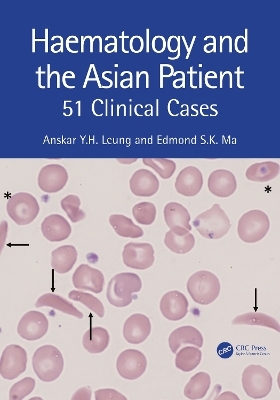 Haematology and the Asian Patient - Anskar Y.H. Leung, Edmond S K Ma