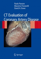 CT Evaluation of Coronary Artery Disease - P. Pavone, Massimo Fioranelli