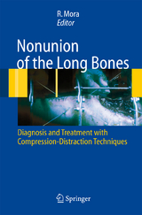 Nonunion of the Long Bones - 