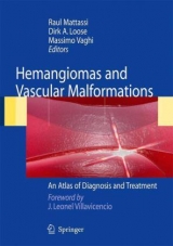 Hemangiomas and Vascular Malformations - 