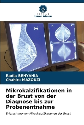 Mikrokalzifikationen in der Brust von der Diagnose bis zur Probenentnahme - Radia BENYAHIA, Chahira MAZOUZI