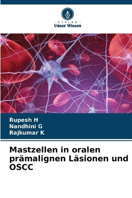 Mastzellen in oralen prämalignen Läsionen und OSCC - Rupesh H, Nandhini G, Rajkumar K