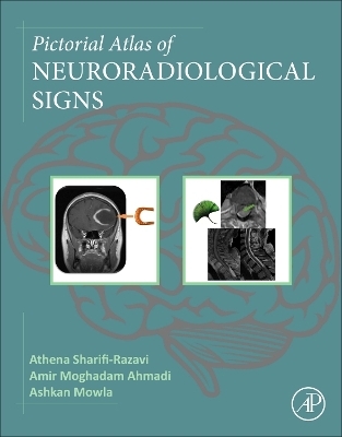 Pictorial Atlas of Neuroradiological Signs - Athena Sharifi-Razavi, Amir Moghadam Ahmadi, Ashkan Mowla