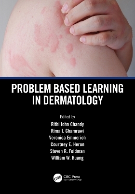 Problem Based Learning in Dermatology - 