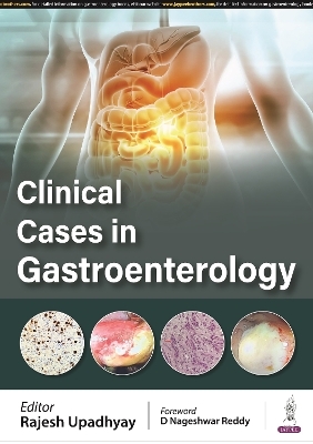 Clinical Cases in Gastroenterology - Rajesh Upadhyay