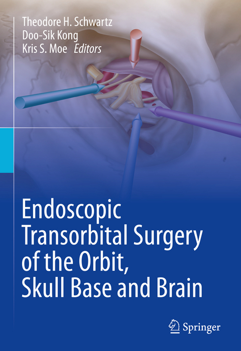 Endoscopic Transorbital Surgery of the Orbit, Skull Base and Brain - 