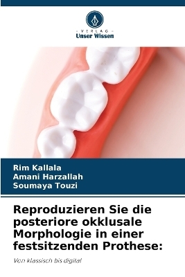 Reproduzieren Sie die posteriore okklusale Morphologie in einer festsitzenden Prothese - Rim Kallala, Amani Harzallah, Soumaya Touzi