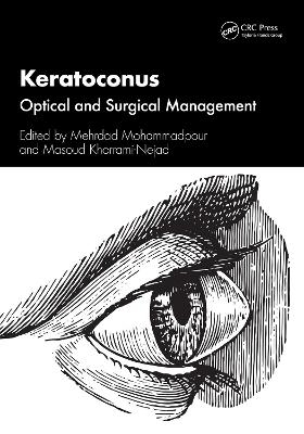 Keratoconus - 