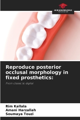 Reproduce posterior occlusal morphology in fixed prosthetics - Rim Kallala, Amani Harzallah, Soumaya Touzi