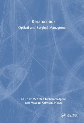 Keratoconus - 