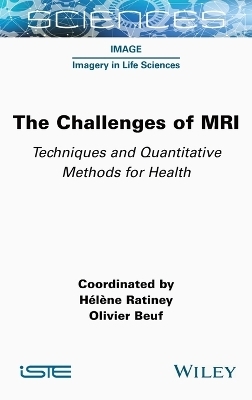 The Challenges of MRI - 