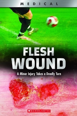 Flesh Wound: A Minor Injury Takes a Deadly Turn (Xbooks) - Shea Phillips