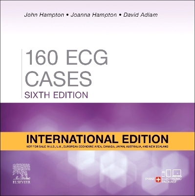 160 ECG Cases, International Edition - John Hampton, Joanna Hampton, David Adlam